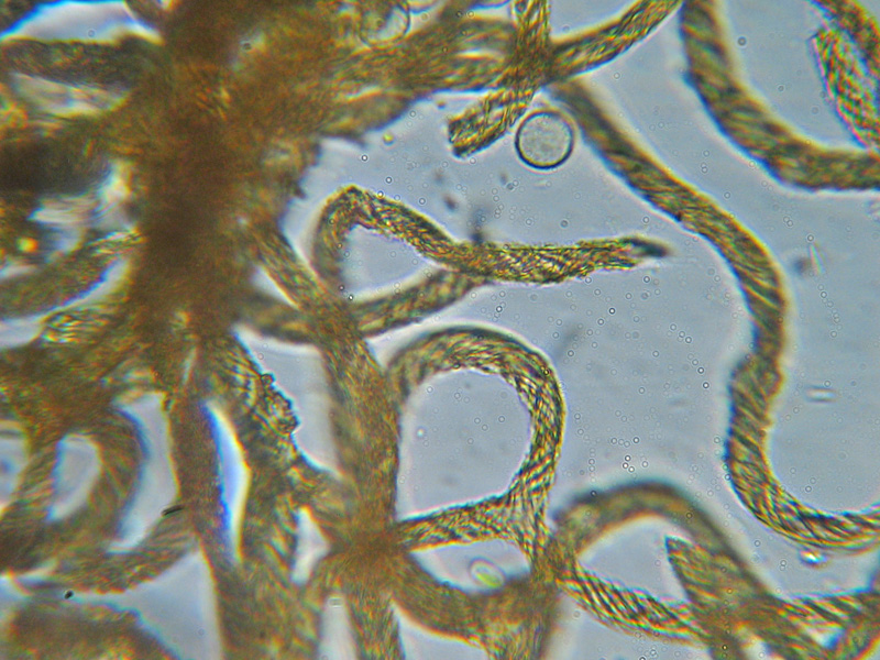 Ma non spariscono mai ?